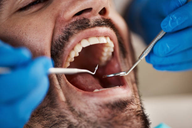 Best Emergency Treatment for Toothache in Union Hall, VA