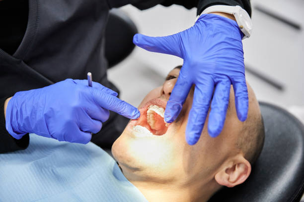 Best Same-Day Emergency Dentist in Union Hall, VA