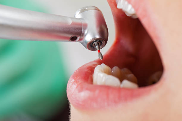Best Urgent Dental Care in Union Hall, VA